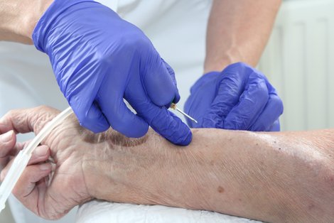 Pflegerin sticht Nadel in Arm 