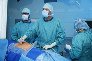 Ärzteteam im OP