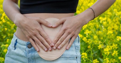 Person legt beide Hände schützend auf ein Stoma am Bauch in einer blühenden Wiesenlandschaft.