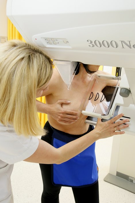 Mitarbeiterin platziert Brust einer Patientin im Gerät