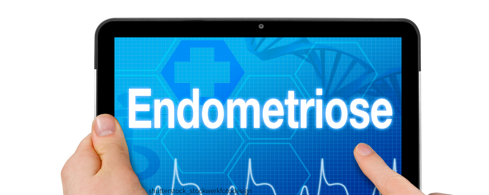 Hände halten Tablet mit dem Text "Endometriose".